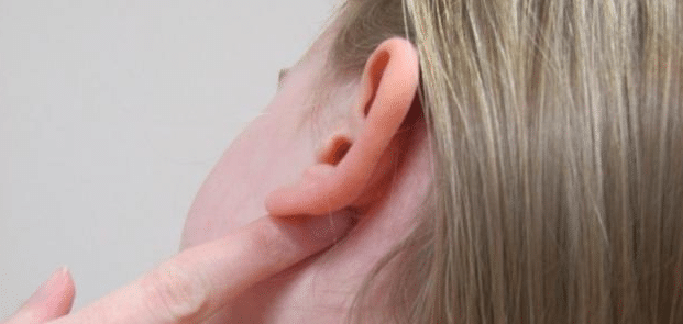 تعرف على أسباب الرائحة الكريهة خلف الأذن وكيفية علاجها