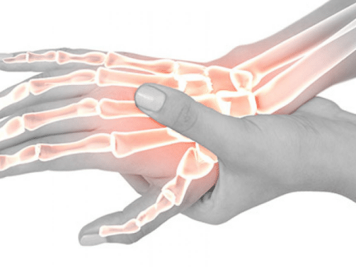 أسباب وأعراض التهاب أوتار اليد