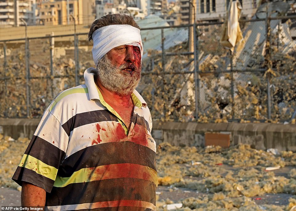 رجل مصاب يسير بالقرب من مكان الانفجار في بيروت