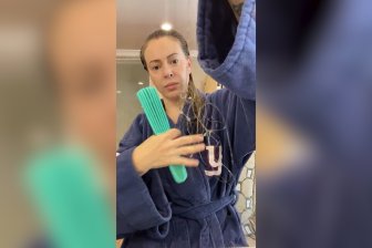 alyssa milano hair loss