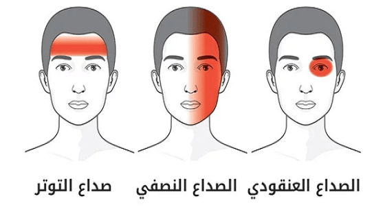 أسباب الصداع وطرق التخلص منها بدون أدوية