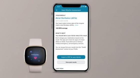 Fitbit Sense تكتسب وظائف تخطيط القلب في الولايات المتحدة وأوروبا