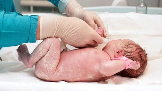 أسباب تقشر جلد الأطفال حديثي الولادة وكيفية العلاج