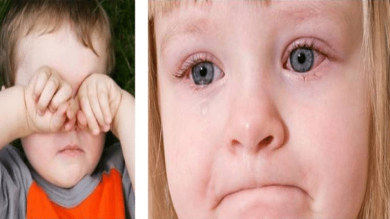 اسباب احمرار العين عند الأطفال وكيف يمكن علاجه