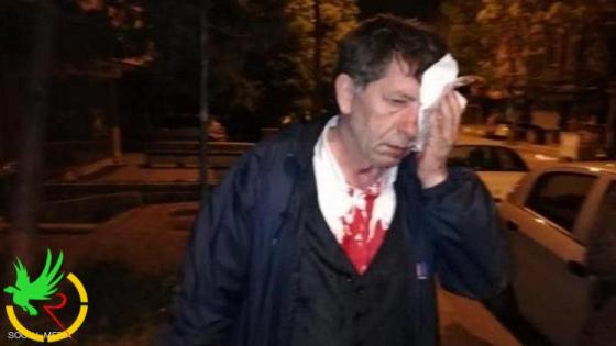 هجوم على صحفي معارض ناقد لحكومة الرئيس التركي