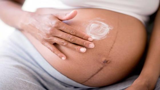 أسباب ظهور كلف الحمل في البطن